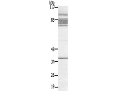 兔抗ZDHHC15多克隆抗体  
