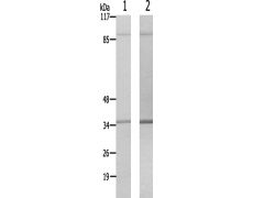 兔抗CDH15多克隆抗体