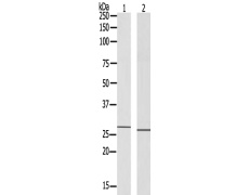 兔抗ZNF575多克隆抗体  