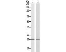兔抗ZNF695多克隆抗体  