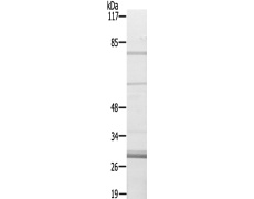 兔抗CEP76多克隆抗体