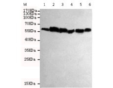小鼠抗ALDH2单克隆抗体  