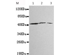 小鼠抗ALDH3A2单克隆抗体 