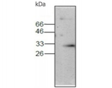 小鼠抗ANXA4单克隆抗体  