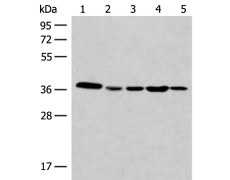 小鼠抗CAPZA1单克隆抗体  