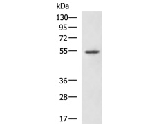 小鼠抗CASP8单克隆抗体  
