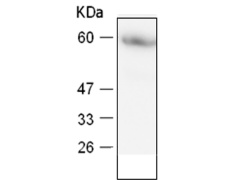 小鼠抗CCT5单克隆抗体  