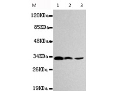 小鼠抗CDK4单克隆抗体  