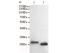 小鼠抗CDKN1B单克隆抗体 