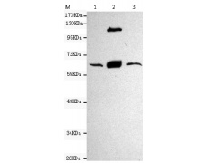小鼠抗CYP17A1单克隆抗体  