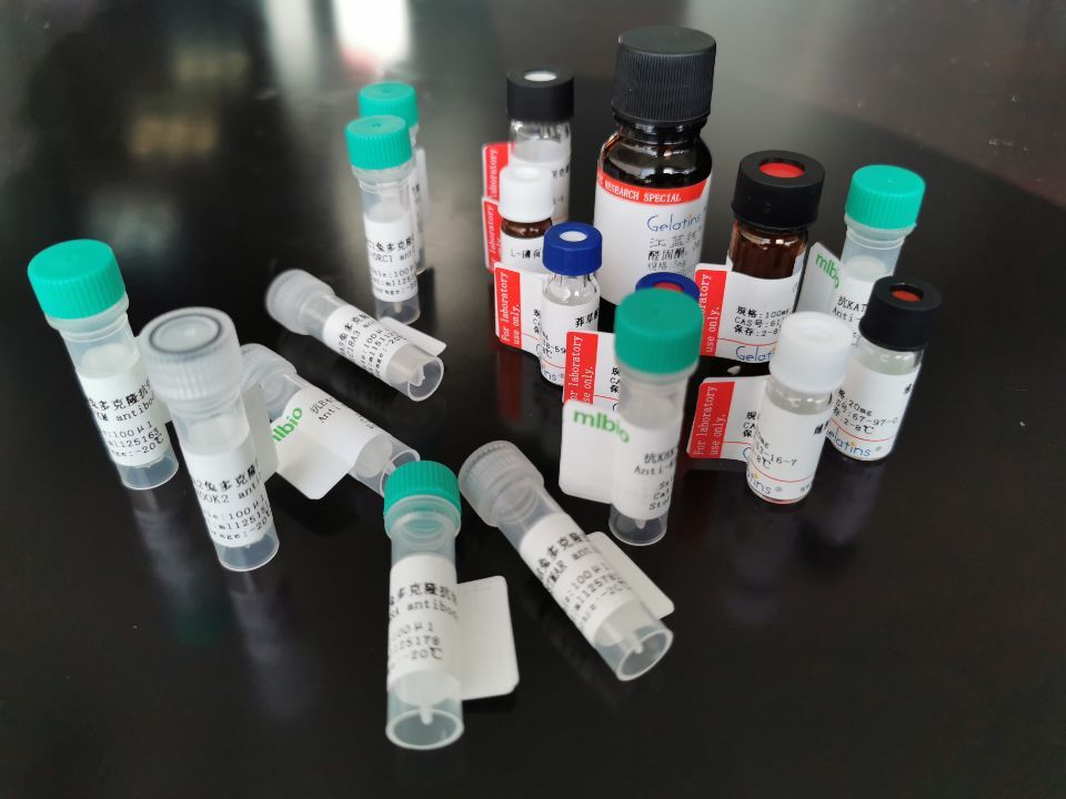 免疫组化试剂盒（适用于兔/小鼠一抗）