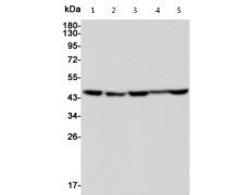 小鼠抗ENO1单克隆抗体 