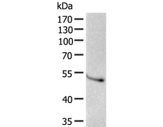 小鼠抗IDH2单克隆抗体 
