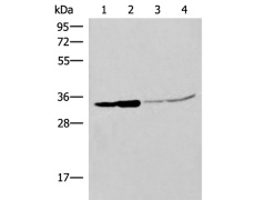 小鼠抗IL1B单克隆抗体 