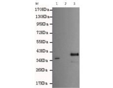 小鼠抗IL18BP单克隆抗体  