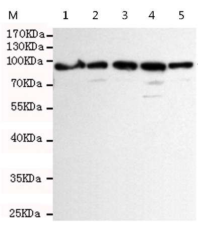 小鼠抗MSH2单克隆抗体  