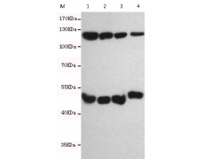 小鼠抗NFKB1单克隆抗体 
