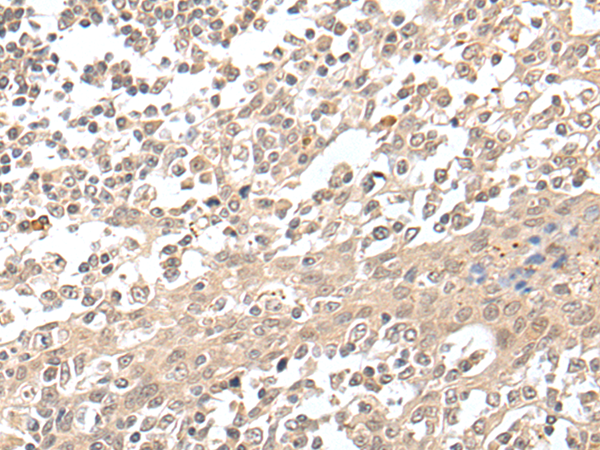 兔抗HCN3多克隆抗体