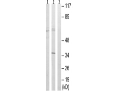 兔抗FYN(Ab-530) 多克隆抗体 