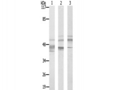 兔抗G3BP2多克隆抗体 