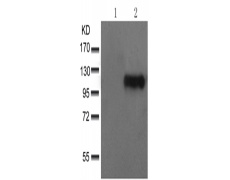 兔抗ITGB3 (Phospho-Tyr785)多克隆抗体