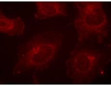 兔抗GAB1(Phospho-Tyr627)多克隆抗体 