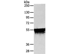 兔抗KRT4多克隆抗体