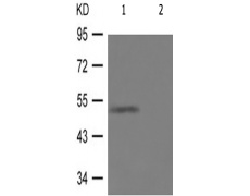 兔抗KRT8(Phospho-Ser432) 多克隆抗体