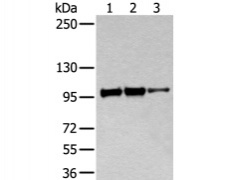 兔抗ACTN1多克隆抗体