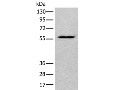 兔抗LDHD多克隆抗体