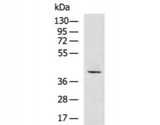 兔抗ACKR3多克隆抗体