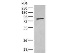 兔抗ADAM21多克隆抗体