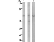 兔抗AGBL4多克隆抗体