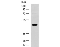 兔抗DNAJA4多克隆抗体