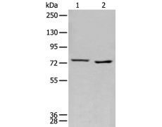 兔抗MEN1多克隆抗体