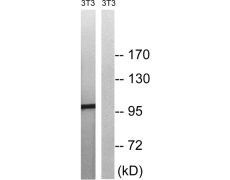 兔抗MERTKTYRO3(Phospho-Tyr749681) 多克隆抗体