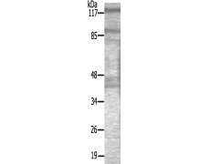 兔抗MET(Ab-1003)多克隆抗体