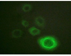 兔抗MET(Ab-1003)多克隆抗体
