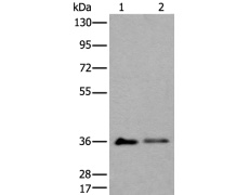 兔抗METAP1D多克隆抗体