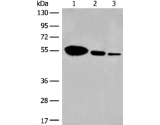 兔抗DYNC1LI2多克隆抗体