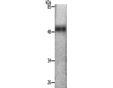 兔抗MITF(Ab-18073) 多克隆抗体