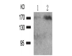 兔抗EGFR (Phospho-Tyr1172)多克隆抗体