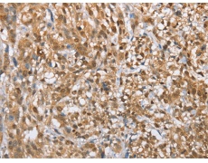兔抗MMP12多克隆抗体