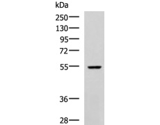 兔抗MMP23B多克隆抗体