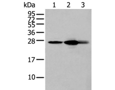 兔抗GSTM4多克隆抗体 