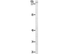 兔抗EIF2AK3(Ab-982)多克隆抗体
