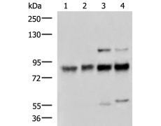 兔抗GTF3C4多克隆抗体 