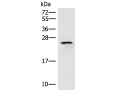 兔抗EIF3K多克隆抗体