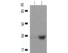 兔抗EIF4E (Phospho-Ser209)多克隆抗体
