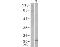 兔抗EIF4EBP1(Phospho-Thr37)多克隆抗体